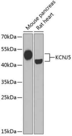 TfR (Transferrin R) Rabbit anti-Human, Mouse, Rat, Polyclonal, Novus Biologicals